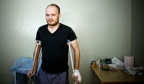 Блогера Олега Кашина избили вскоре после стычки с Андреем Турчаком Блогера Олега Кашина избили вскоре после стычки с Андреем Турчаком