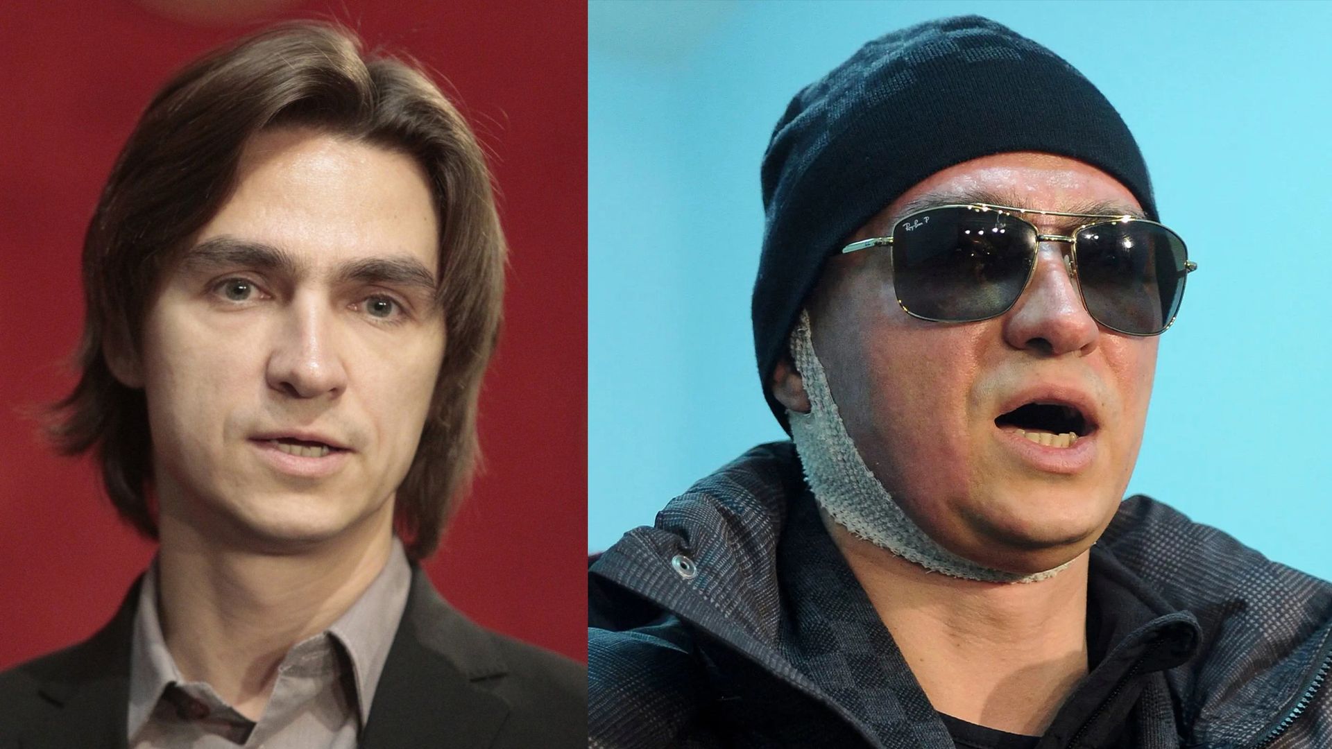 Сергей Филин до и после нападения