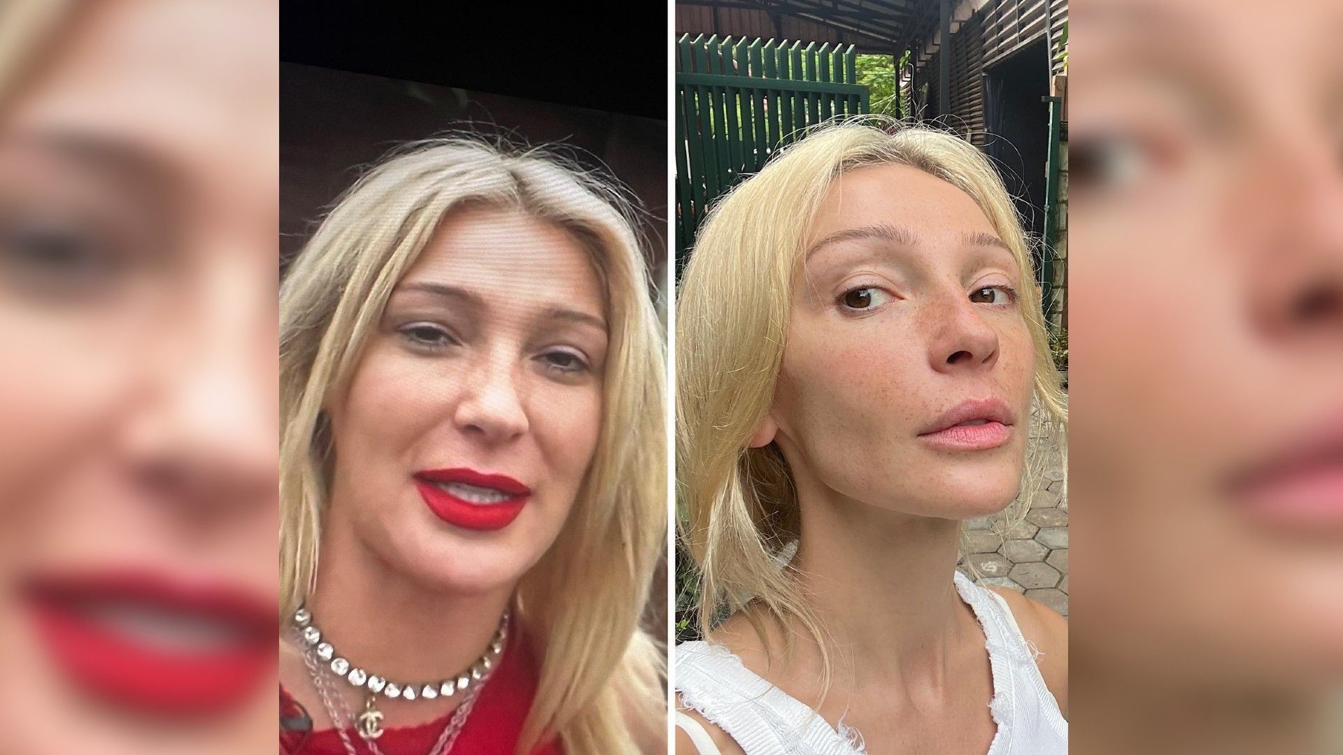 Лицо блогерши тоже сильно похудело