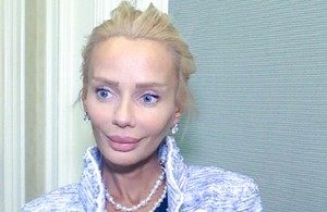 Кристина Сысоева делала пластику?