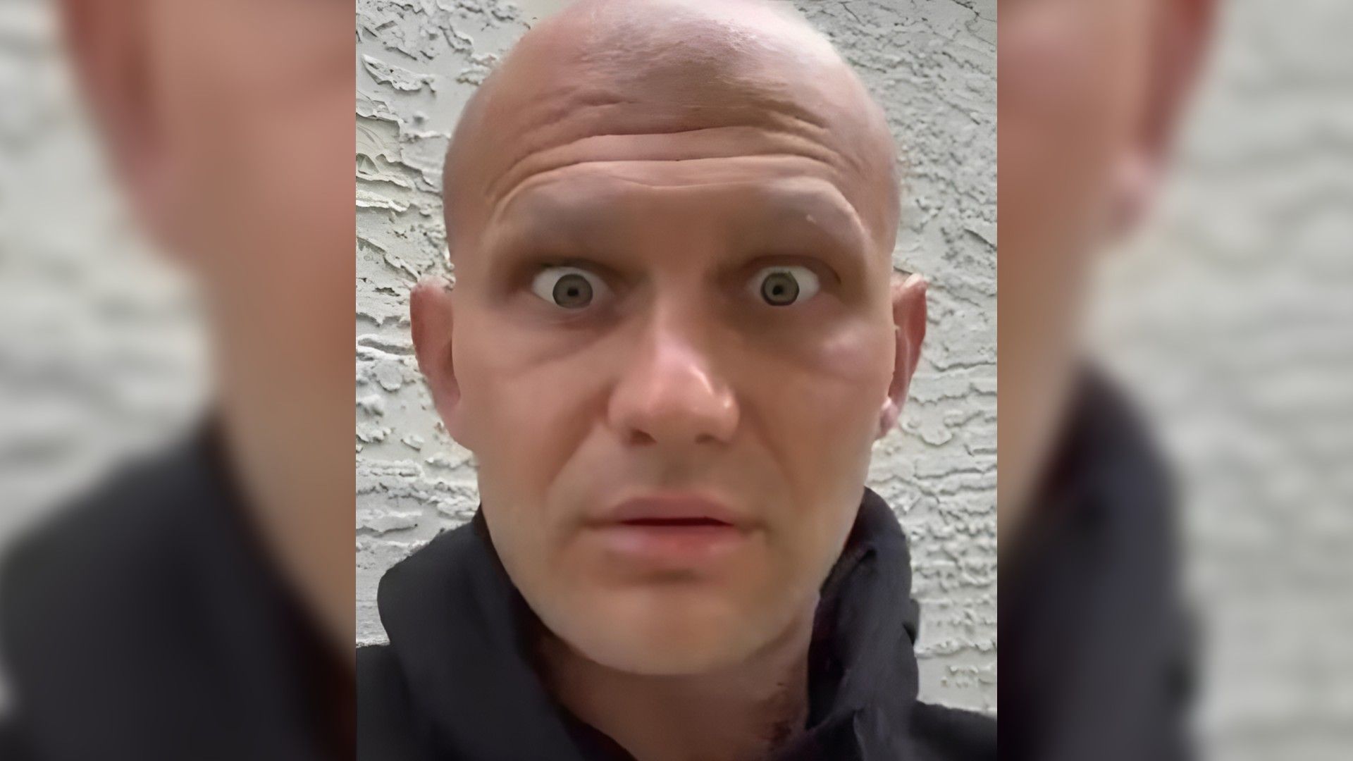 Лысый мужчина со сбритыми бросями и удивлённым взглядом