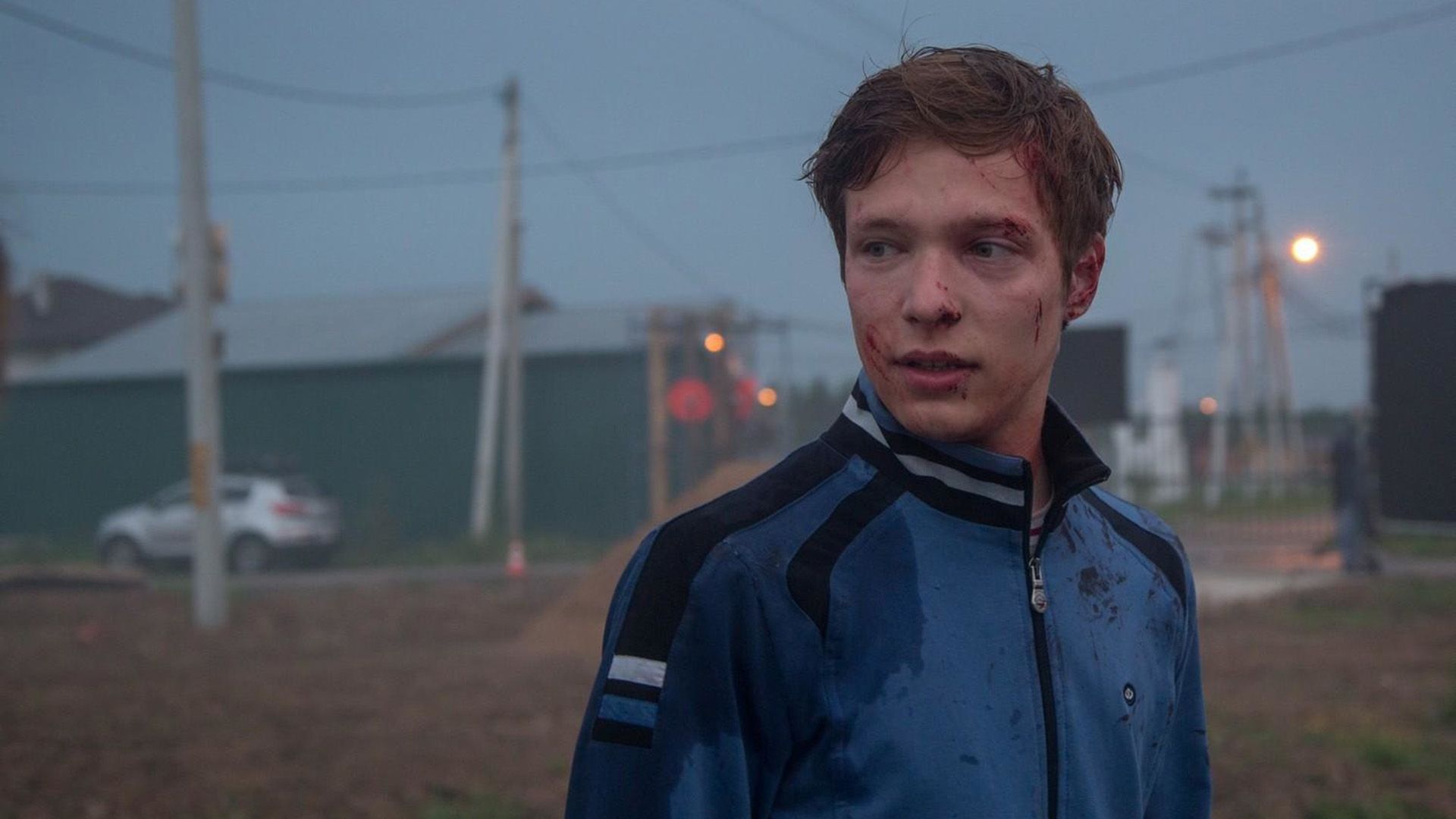 Сергей Городничий в синей спортивной куртке и со ссадинами на лице