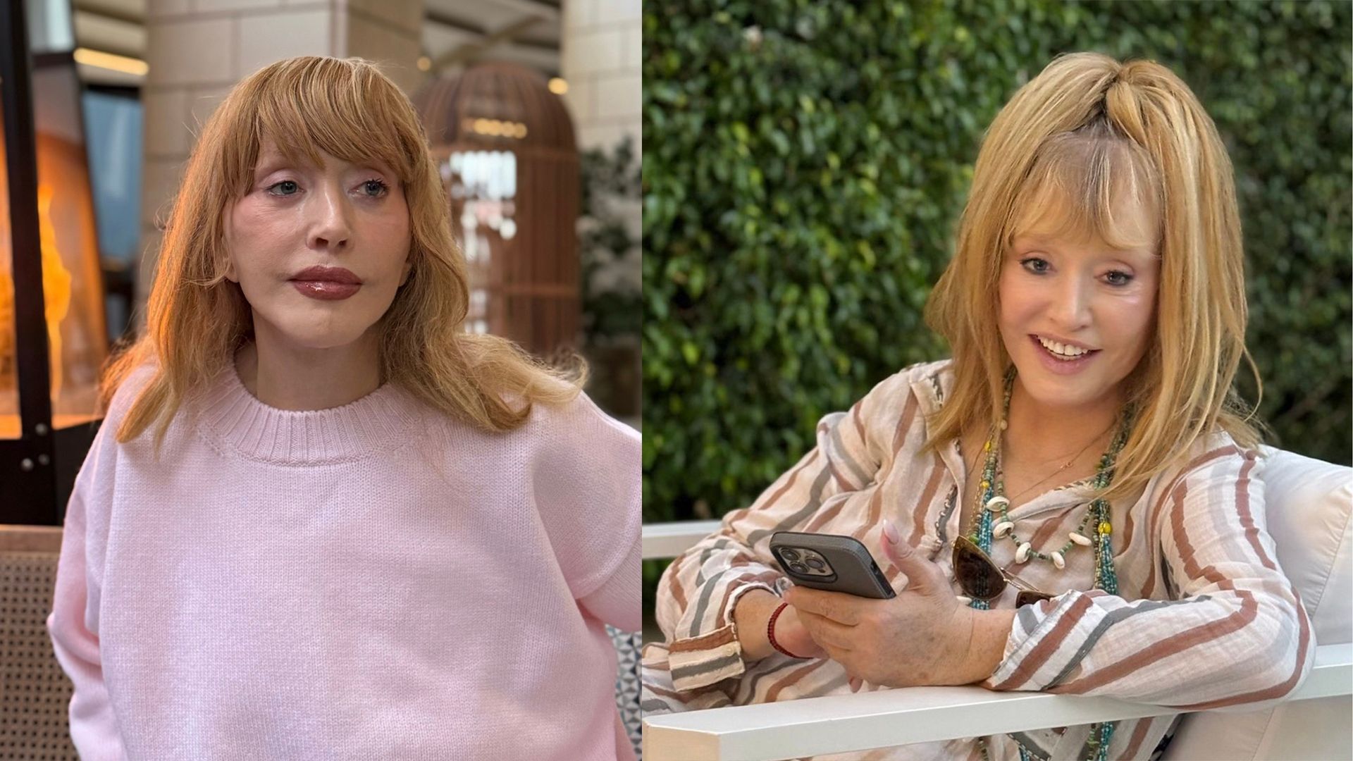 Аллу Пугачеву впервые сфотографировали с тростью: похудевшее лицо и ни одного фильтра