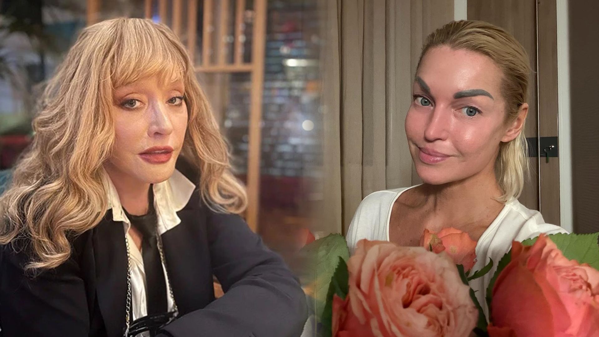 Волочкова рассказала, как Пугачева поддержала ее после операции