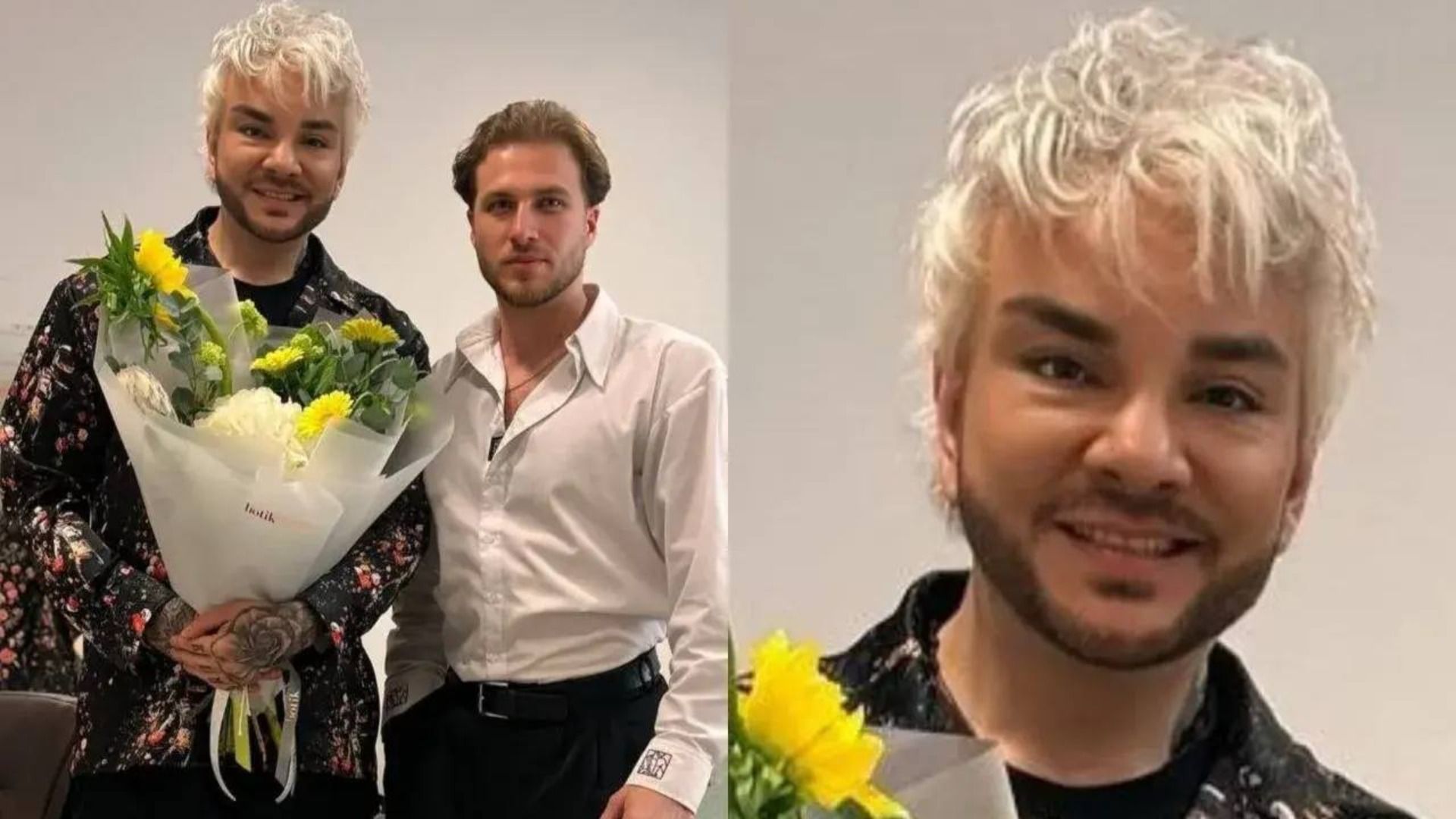 В соцсетях не узнали Киркорова из-за опухшего на фоне аллергии лица