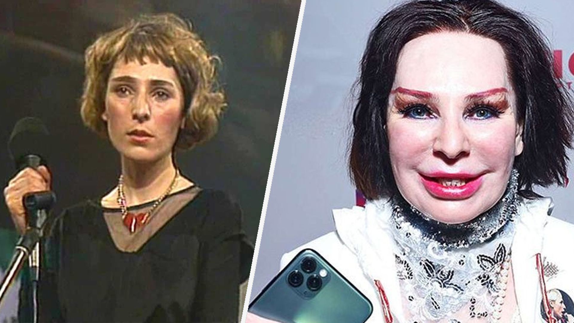 Было лучше: 9 отечественных звезд, которых сложно узнать после пластики