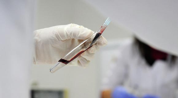 Группа ученых открыла способ выявить рак у человека по капле крови